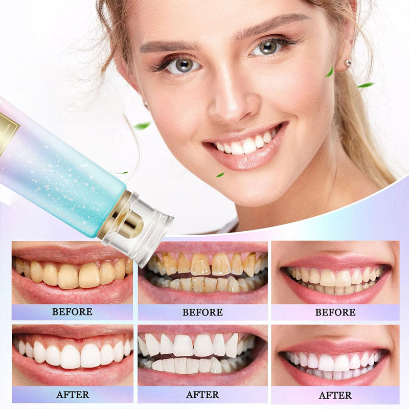 Dentifricio sbiancante