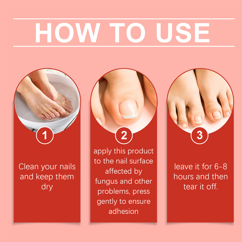Cerotti per unghie affette da micosi – Trattamento per la cura delle unghie ad azione rapida e facile da usare